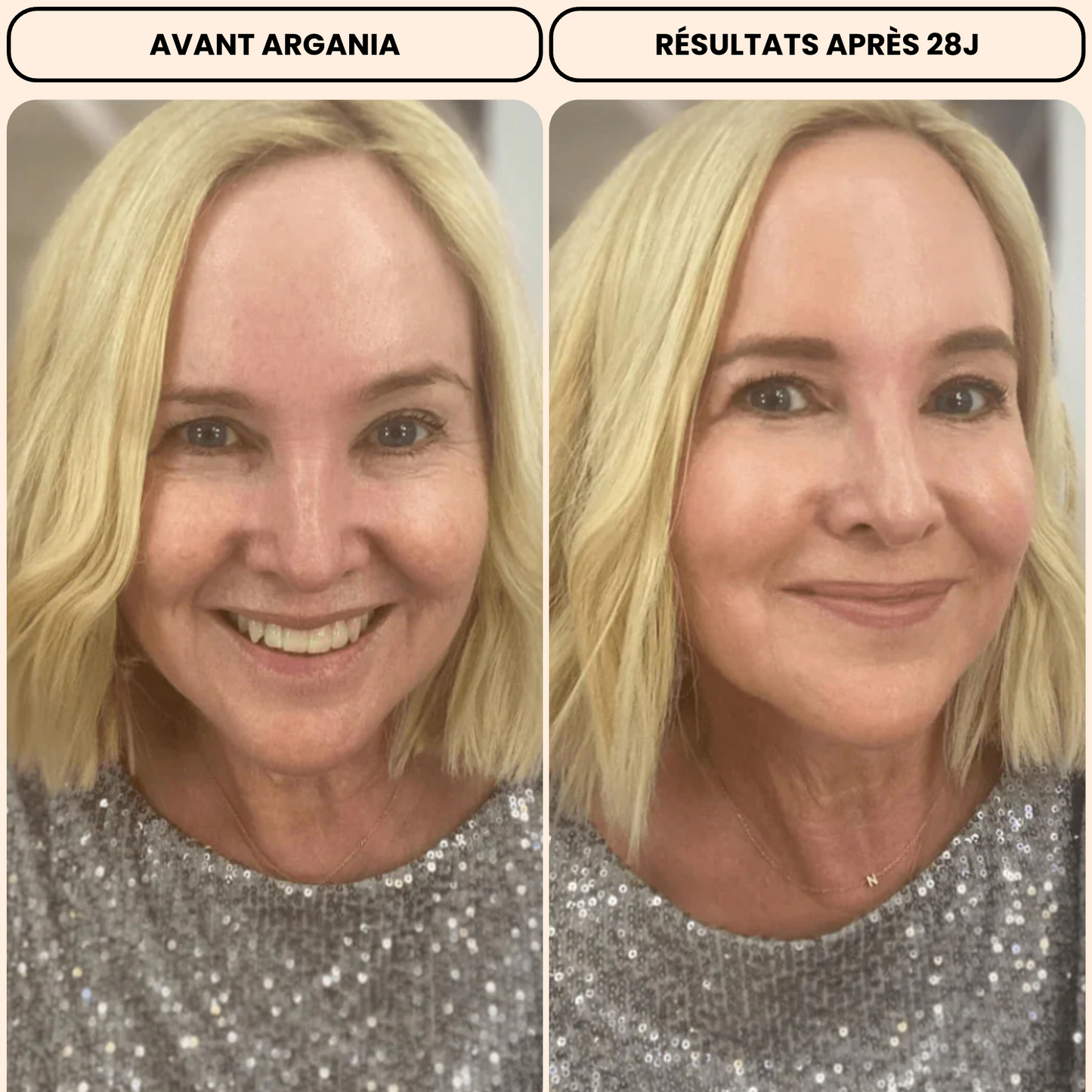 Anti-Aging Pack: Opuntia + Cream Luminia🇨🇭