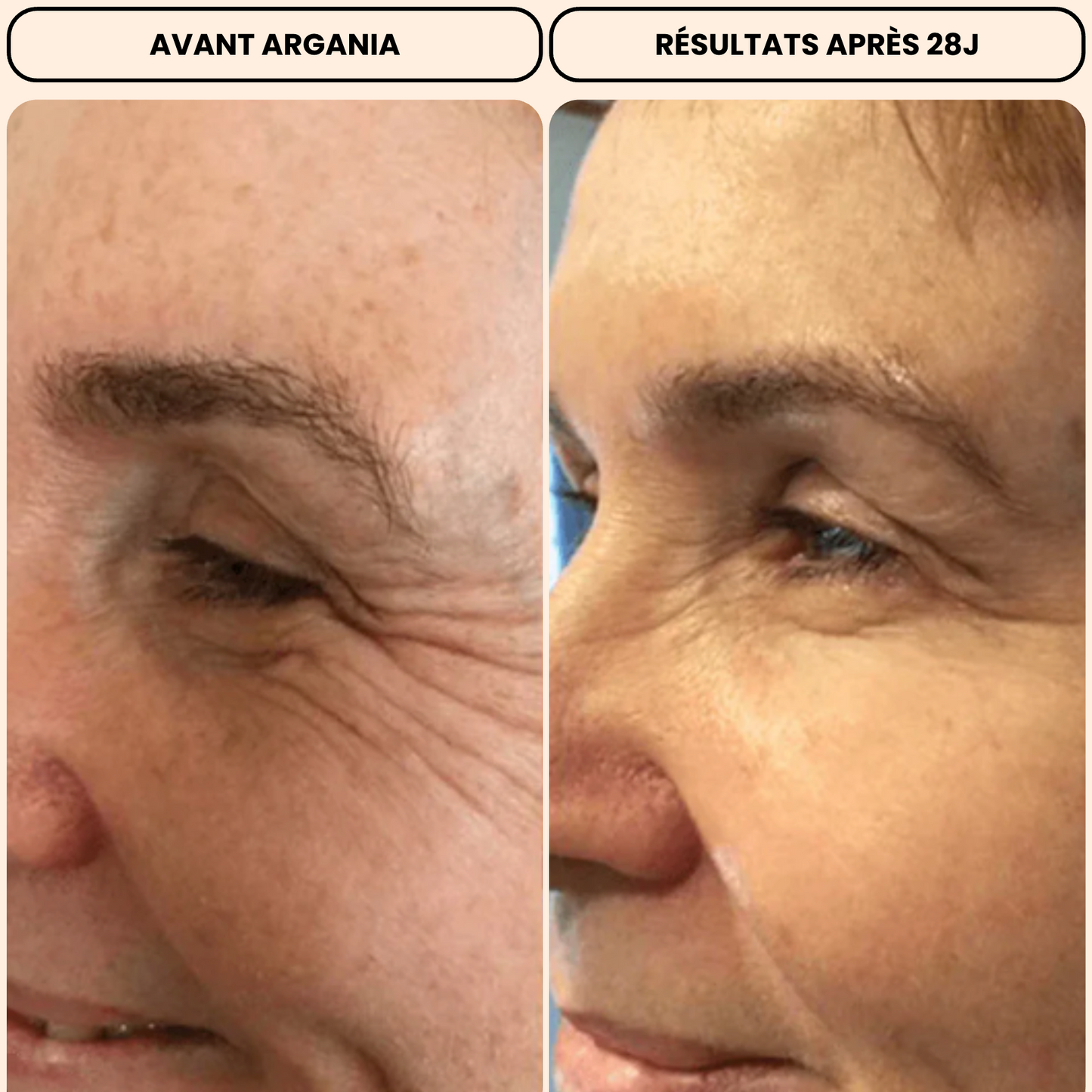 Anti-Aging Pack: Opuntia + Cream Luminia🇨🇭