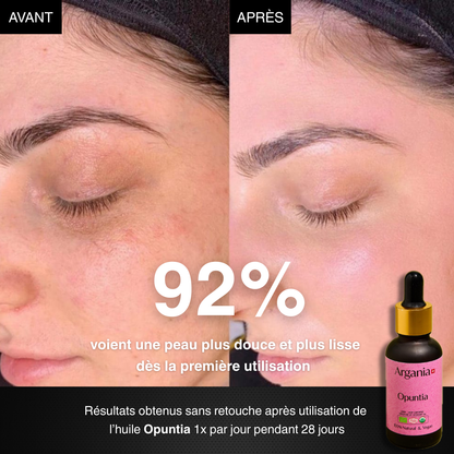 Opuntia® – L'Huile N°1 contre les Rides et les Taches🇨🇭