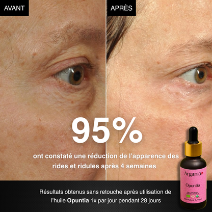 Opuntia® – L'Huile N°1 contre les Rides et les Taches🇨🇭