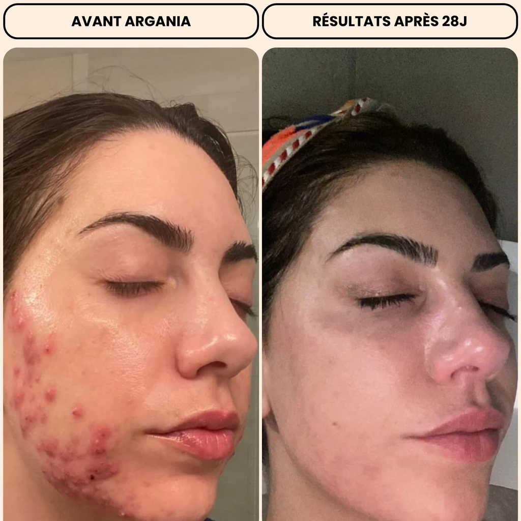 Huile de Nigelle Bio Nigella Aura® Peau Nette