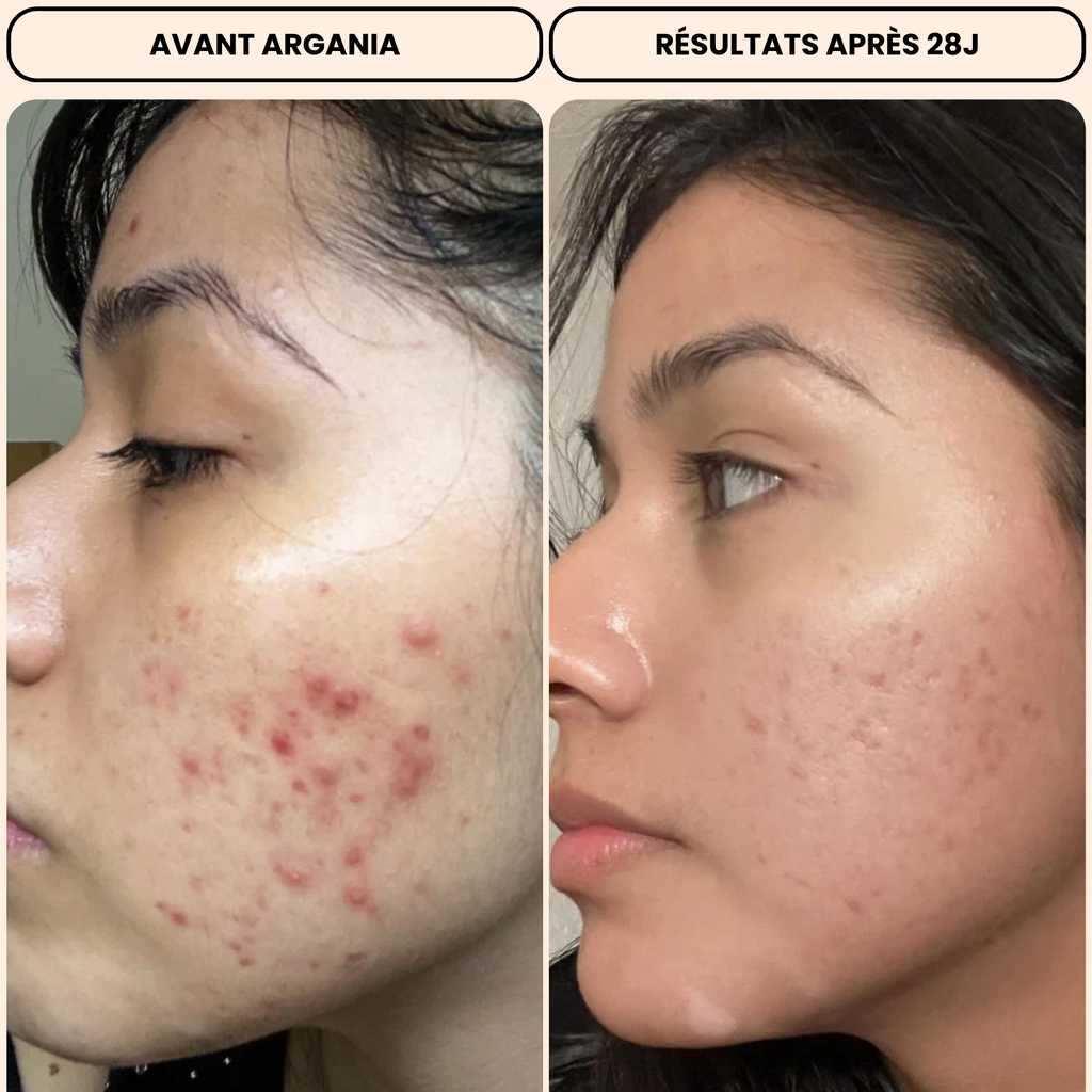 Huile de Nigelle Bio Nigella Aura® Peau Nette