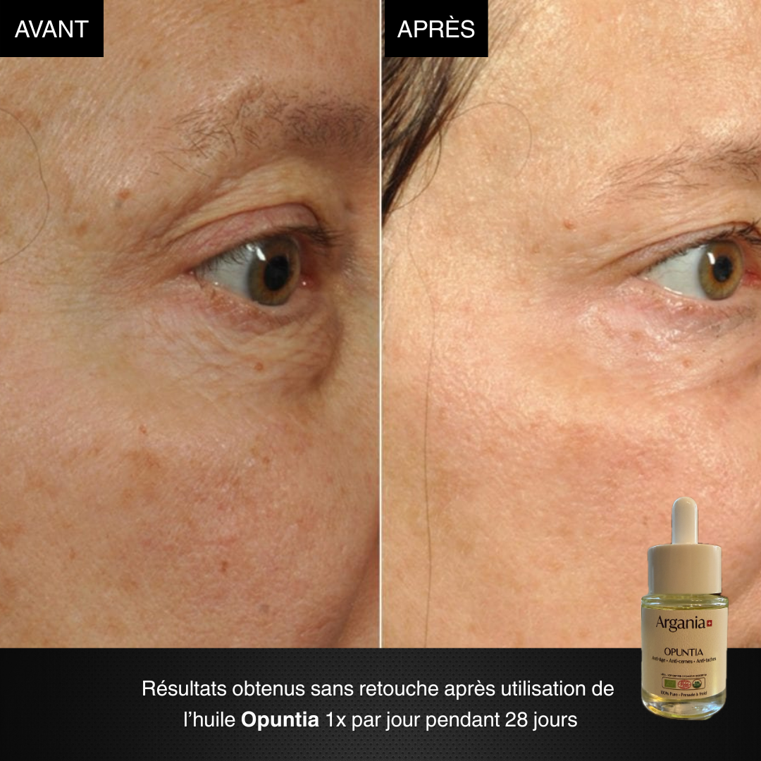 Prima e dopo Opuntia® — rughe attenuate e incarnato uniforme in 28 giorni