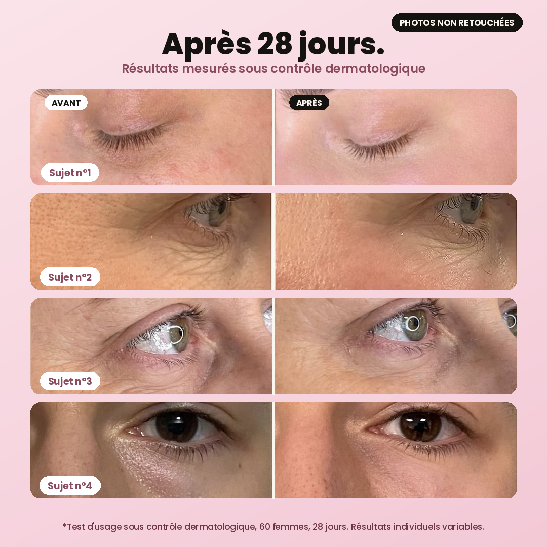 Huile de Pépins de Figue de Barbarie Bio Opuntia® Anti-Âge