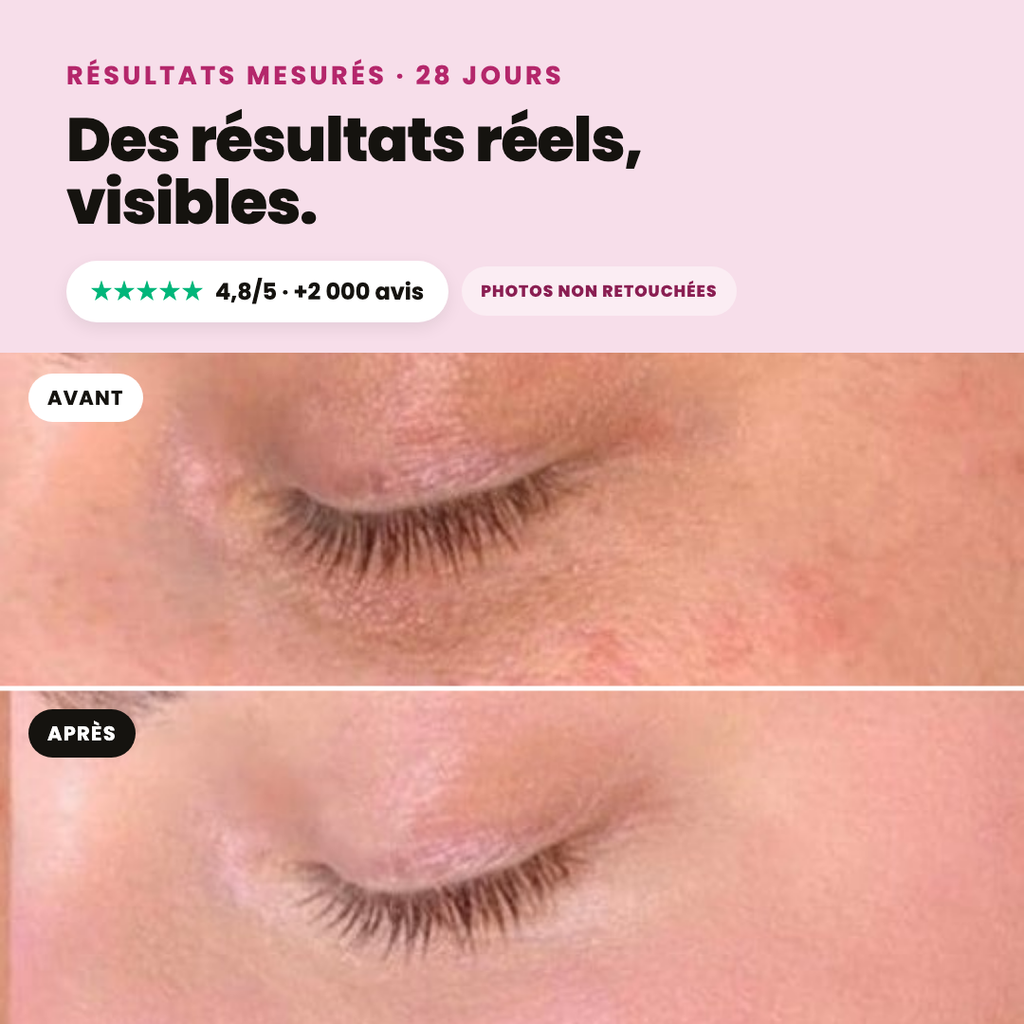 Bio-Kaktusfeigenkernöl Opuntia® Anti-Aging