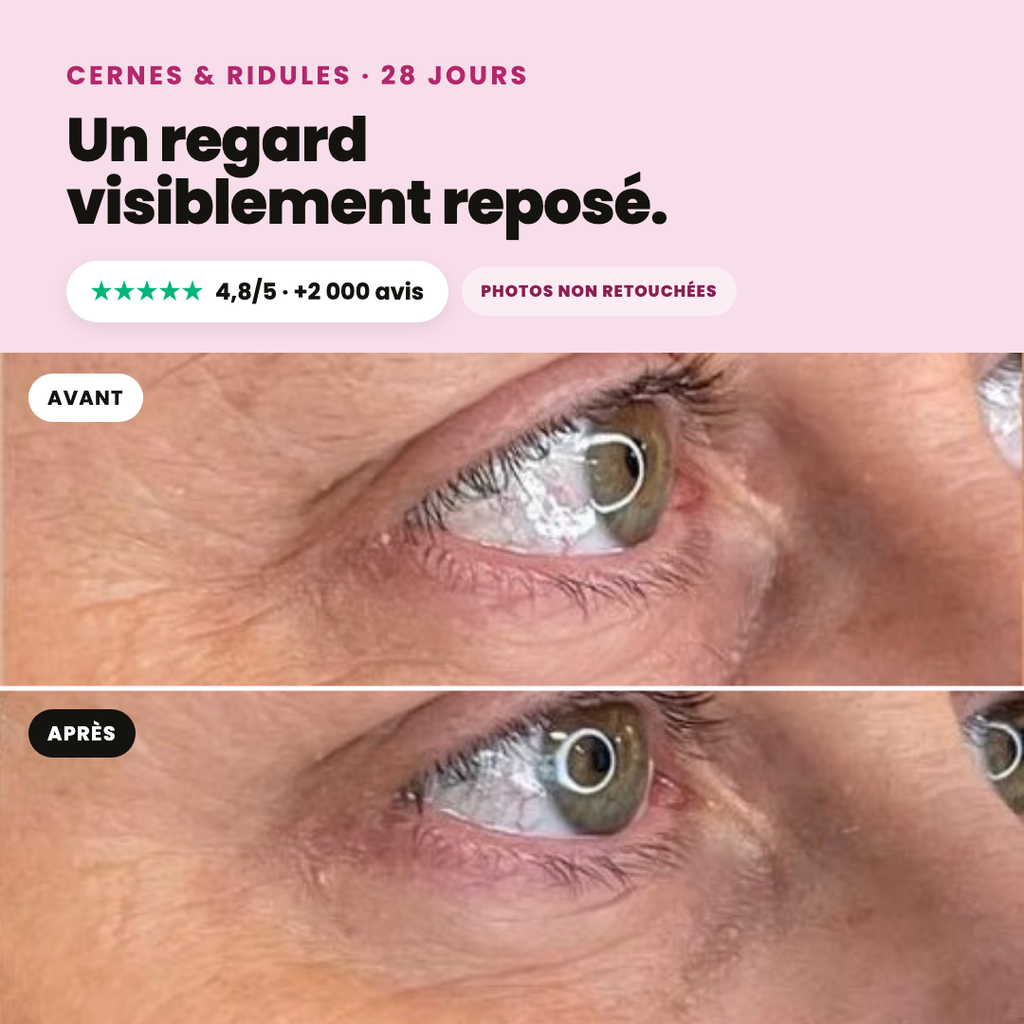 Bio-Kaktusfeigenkernöl Opuntia® Anti-Aging