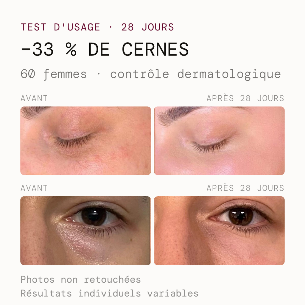 Prima e dopo 28 giorni su due partecipanti: −33% delle occhiaie, test di utilizzo sotto controllo dermatologico, foto non ritoccate