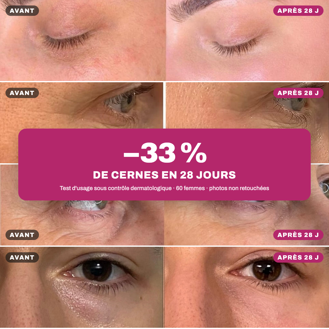 Bio-Kaktusfeigenkernöl Opuntia® Anti-Aging