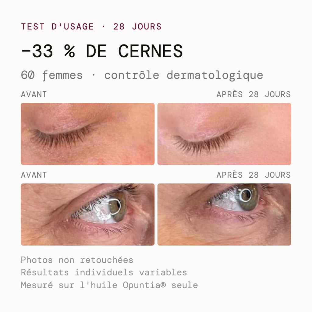 Avant après du test d'usage Opuntia — cernes atténués en 28 jours, photos non retouchées
